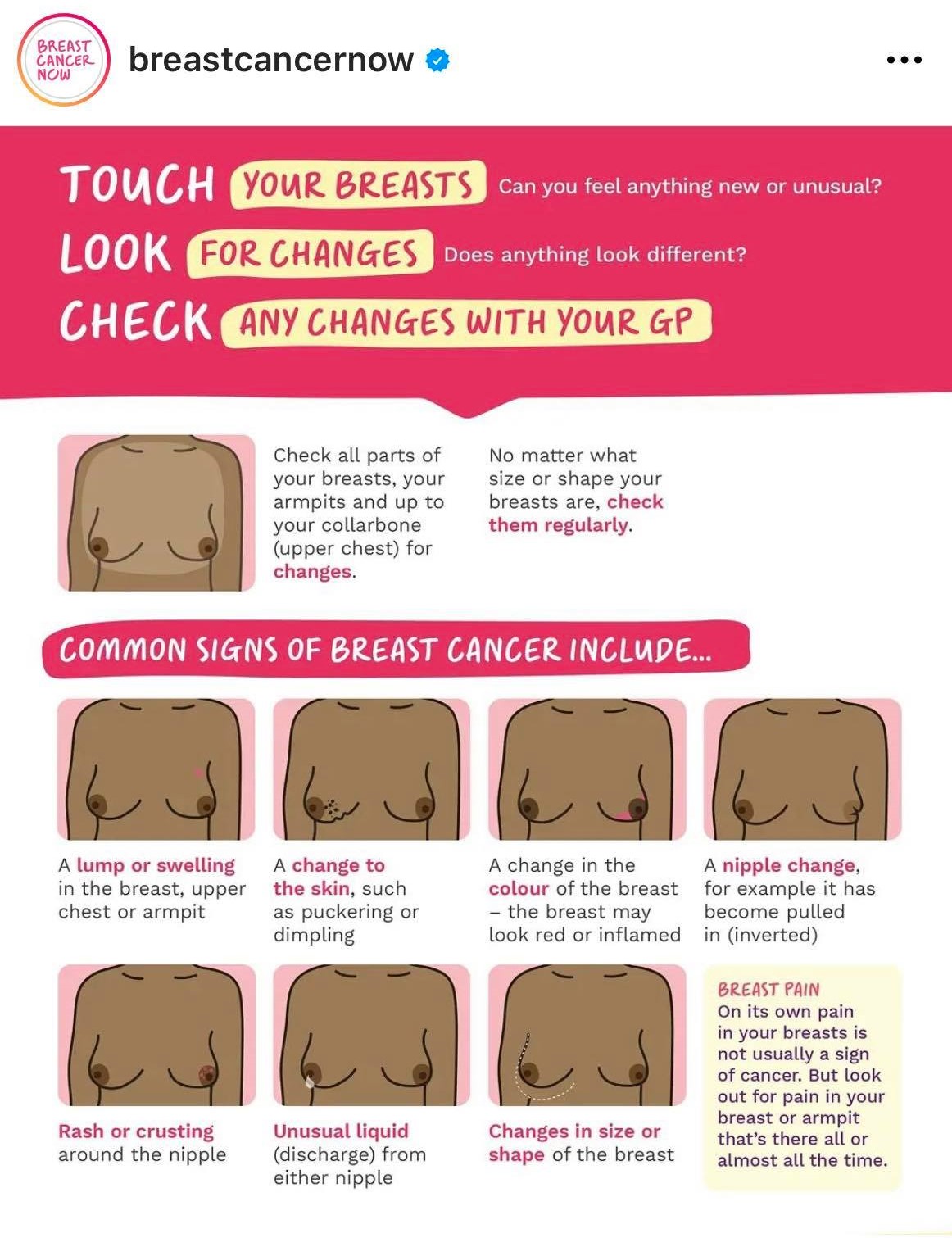 Breast examination graphic
